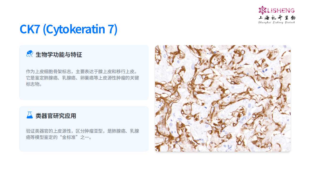 礼升严选类器官抗体-CK7